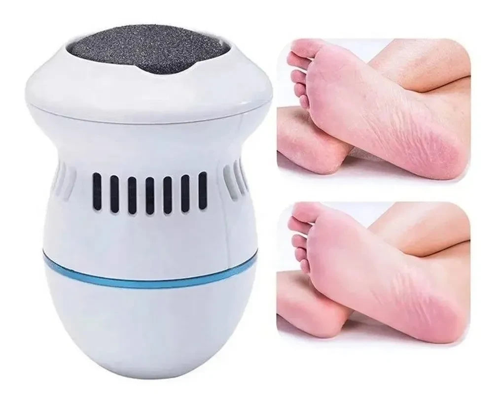 Removedor De Callos Eléctrico Para Pies Clean Feet Con Cabezales Intercambiables